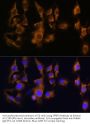 Small Proline Rich Protein 3 (SPRR3) Antibody
