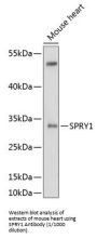 Sprouty Homolog 1 (SPRY1) Antibody