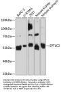 Serine Palmitoyltransferase, Long Chain Base Subunit 2 (SPTLC2) Antibody