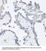 SRC Proto-Oncogene, Non-Receptor Tyrosine Kinase (SRC) Antibody