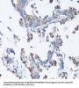 SRC Proto-Oncogene, Non-Receptor Tyrosine Kinase (SRC) Antibody