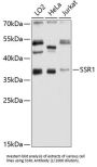 Translocon-Associated Protein Subunit Alpha (SSR1) Antibody