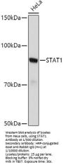 Signal Transducer And Activator of Transcription 1 (STAT1) Antibody