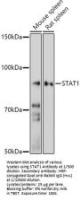 Signal Transducer And Activator of Transcription 1 (STAT1) Antibody