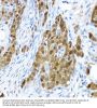 Signal Transducer And Activator of Transcription 1 (STAT1) Antibody
