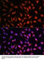 Signal Transducer And Activator of Transcription 1 (STAT1) Antibody