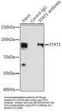 Signal Transducer And Activator of Transcription 1 (STAT1) Antibody