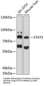 Signal Transducer And Activator of Transcription 3 (STAT3) Antibody