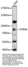 Stimulated By Retinoic Acid 6 (STRA6) Antibody