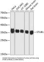STIP1 Homology And U-Box Containing Protein 1 (STUB1) Antibody