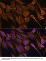 STIP1 Homology And U-Box Containing Protein 1 (STUB1) Antibody