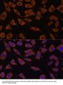 STIP1 Homology And U-Box Containing Protein 1 (STUB1) Antibody