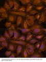 STIP1 Homology And U-Box Containing Protein 1 (STUB1) Antibody