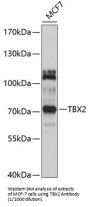T-Box Protein 2 (TBX2) Antibody