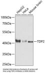 Tyrosyl-DNA Phosphodiesterase 2 (TDP2) Antibody
