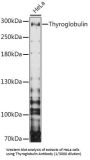Thyroglobulin (TG) Antibody