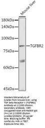 Transforming Growth Factor Beta Receptor 2 (TGFBR2) Antibody