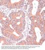 T-Cell Lymphoma Invasion And Metastasis Inducing Protein 1 (TIAM1) Antibody