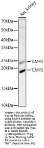 Metalloproteinase Inhibitor 3 (TIMP3) Antibody