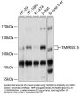 Enteropeptidase (TMPRSS15) Antibody