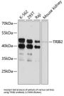 Tribbles Homolog 2 (TRIB2) Antibody