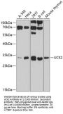 Uridine-Cytidine Kinase 2 (UCK2) Antibody