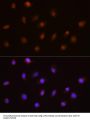 Ubiquitin Specific Peptidase 4 (USP4) Antibody