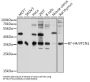 V-Set Domain-Containing T-Cell Activation Inhibitor 1 (VTCN1) Antibody