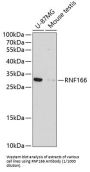 RING Finger Protein 166 (RNF166) Antibody