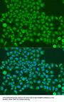 TAR DNA-Binding Protein 43 / TDP43 (TARDBP) Antibody