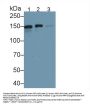 Endoplasmic Reticulum To Nucleus Signalling 1 (ERN1) Antibody