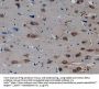 Endoplasmic Reticulum To Nucleus Signalling 1 (ERN1) Antibody