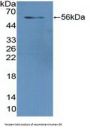 Glutathione Reductase (GR) Antibody
