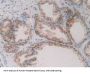 Glutathione Reductase (GR) Antibody