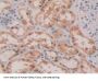 Glutathione Reductase (GR) Antibody