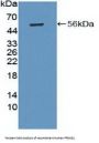 Protein Kinase, AMP Activated Beta 1 (PRKAB1) Antibody