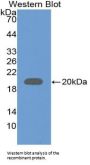 Frataxin (FXN) Antibody