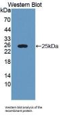 Lectin Galactoside Binding, Soluble 3 Binding Protein (LGALS3BP) Antibody