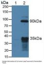 Neurotrophic Tyrosine Kinase Receptor Type 2 (NTRK2) Antibody