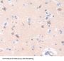 Neurotrophic Tyrosine Kinase Receptor Type 2 (NTRK2) Antibody