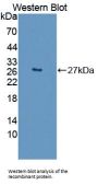 Desmoplakin (DSP) Antibody