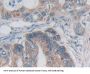 Desmoplakin (DSP) Antibody