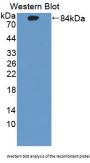 Neuronal Acetylcholine Receptor Subunit Alpha 7 (CHRNA7) Antibody