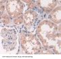 Neuronal Acetylcholine Receptor Subunit Alpha 7 (CHRNA7) Antibody