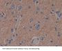 Adenylyl Cyclase Associated Protein 2 (CAP2) Antibody
