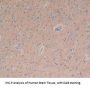 Adenylyl Cyclase Associated Protein 2 (CAP2) Antibody