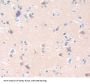 Carbonic Anhydrase VIII (CA8) Antibody