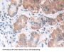 Lipase, Gastric Antibody