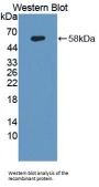 Annexin A11 (ANXA11) Antibody