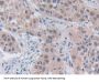 Sex Determining Region Y (SRY) Antibody